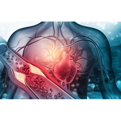 Vascular diseases what are they? UnaVita Klinika Vilniuje